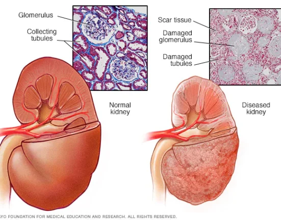 Kidney