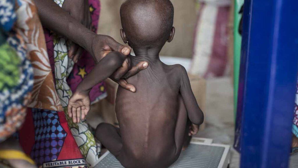 Sudan Hunger