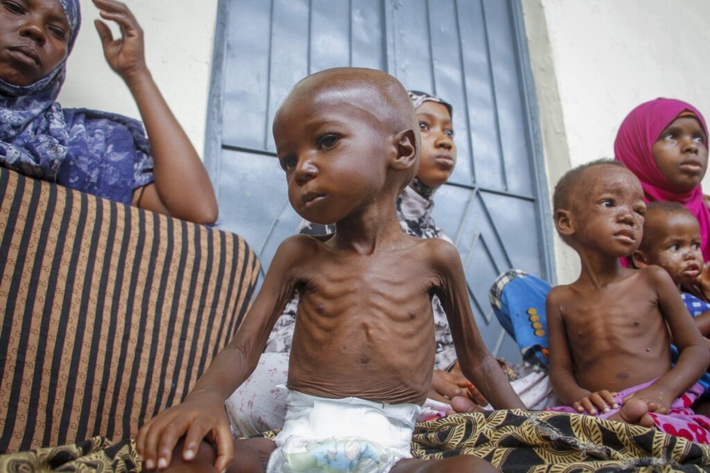 Somalia Child Hunger Crisis Deepens After Aid Cuts, UNICEF Says Somalia Child Hunger